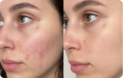 Weeks 5–8 Visible Results